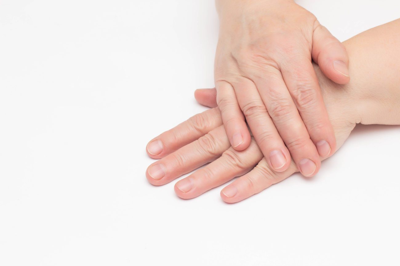 Hand veins treatment