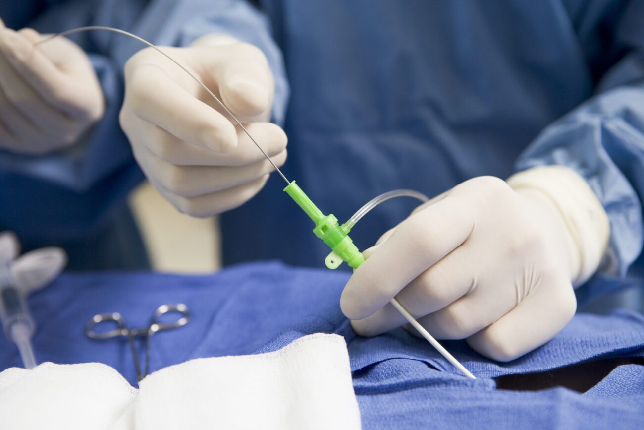 While everyone is different, most people can safely undergo Endovenous laser treatment (EVLT) for varicose vein treatment.